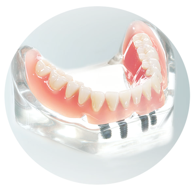 Prothetik • Zahnmedizin Rostock